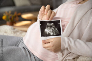 pregnant woman showing a sonogram